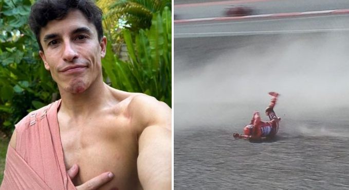 Marc Marquez. Cedera Bahu Parah Di Mandalika